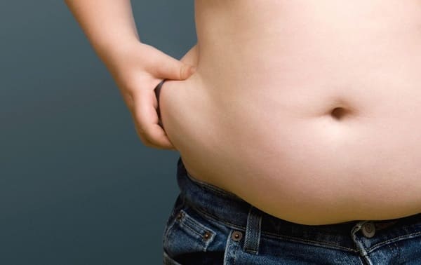 Obesidade Mórbida – O Que é Considerado ?